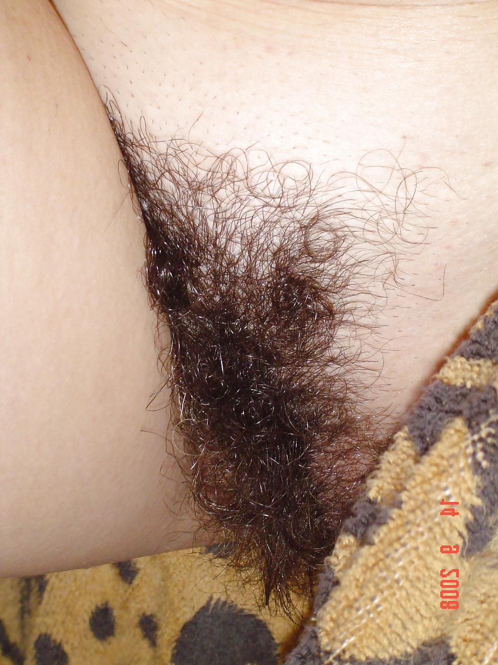 25P Hairy mature 