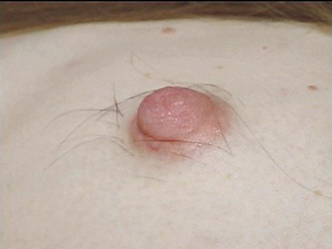 13P Women with hairy breasts