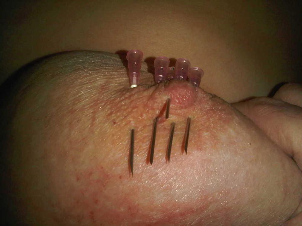 6P Scottish slut with tortured tits!