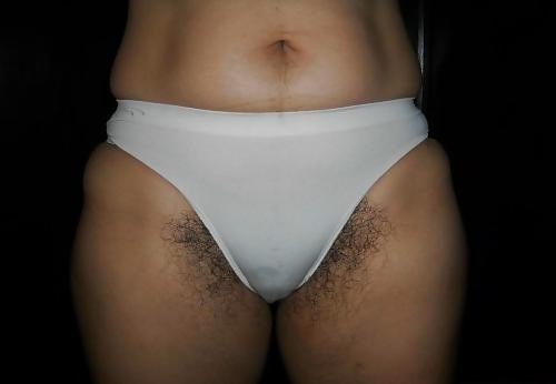 24P Hairy in panties