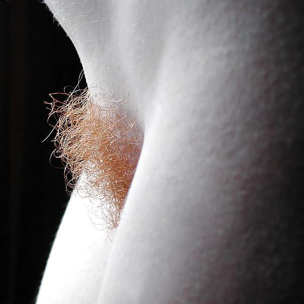 18P Hairy Redheads II