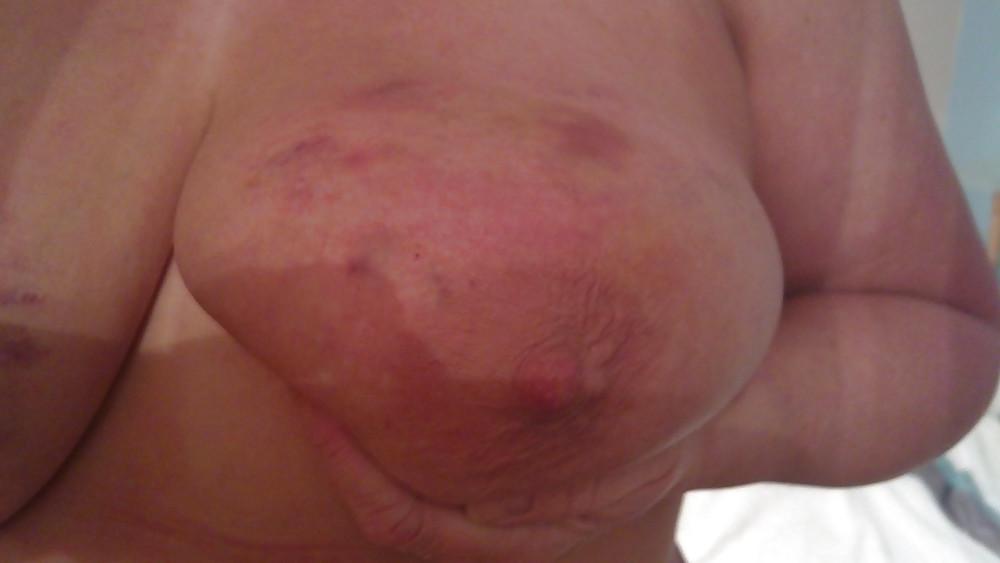 6P Scottish slut tit torture