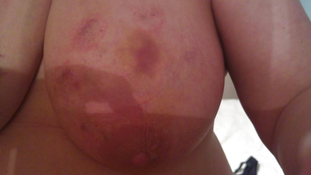 6P Scottish slut tit torture