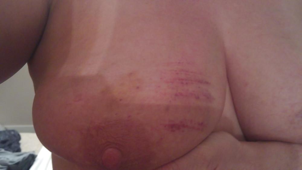 6P Scottish slut tit torture