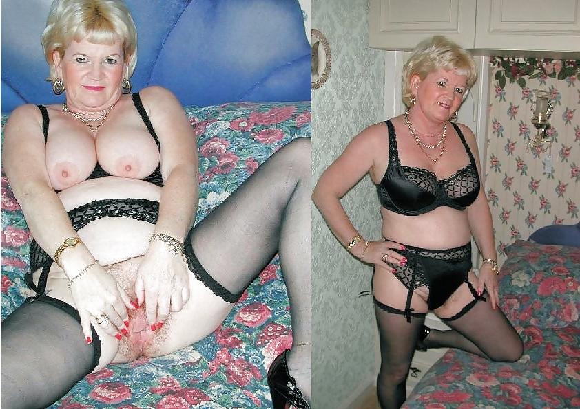 20P Before after 286 (Saggy tits special).