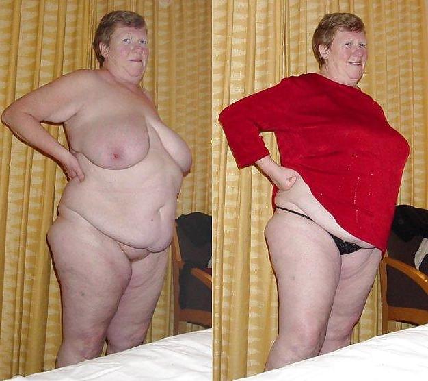 20P Before after 286 (Saggy tits special).