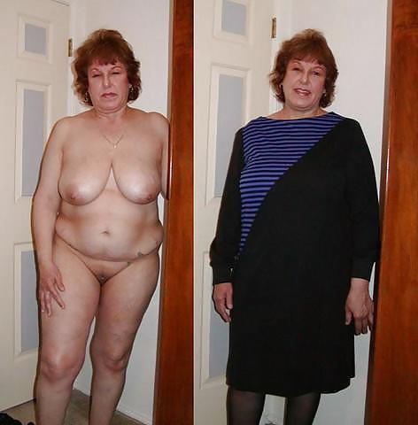 20P Before after 286 (Saggy tits special).
