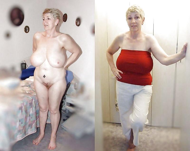 20P Before after 286 (Saggy tits special).
