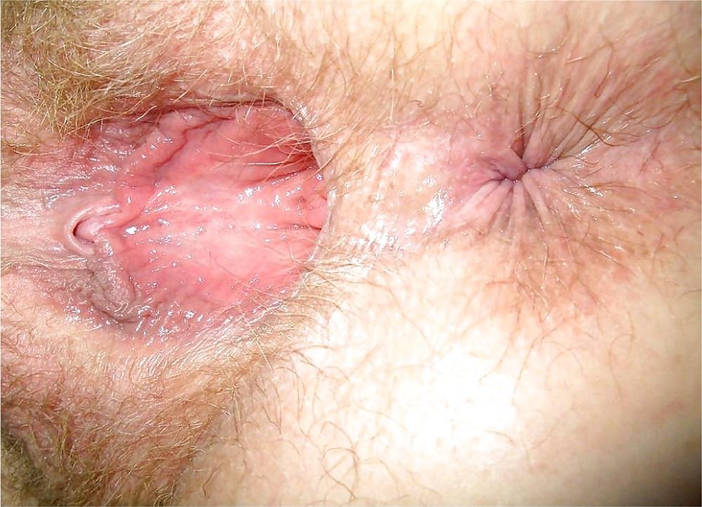 25P Hairy Pussy 
