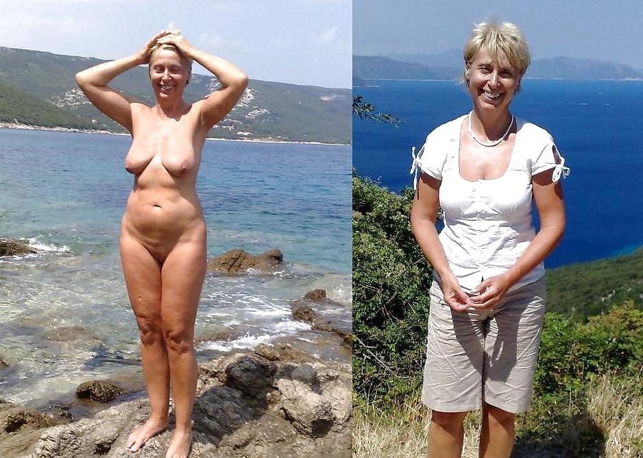 20P Before after 341 (Beach special).