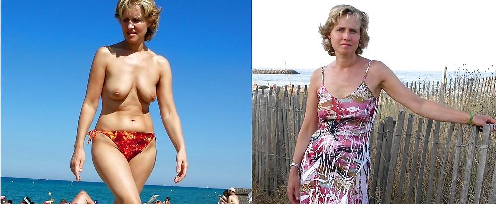 20P Before after 341 (Beach special).