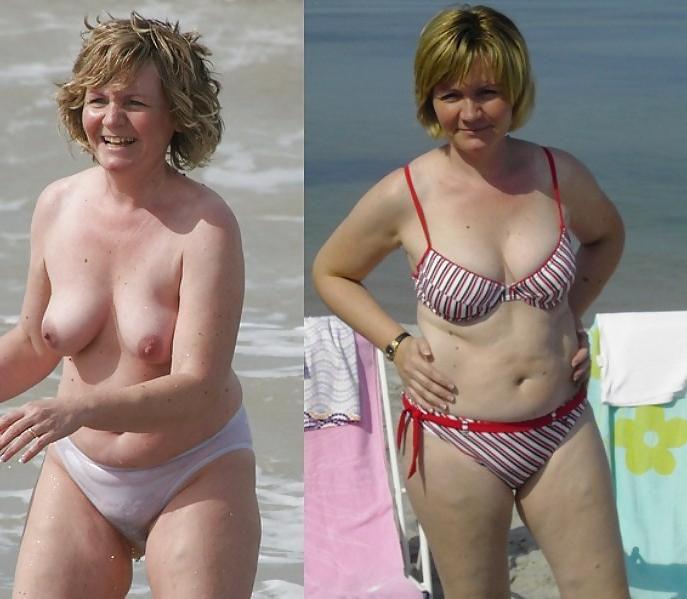 20P Before after 341 (Beach special).