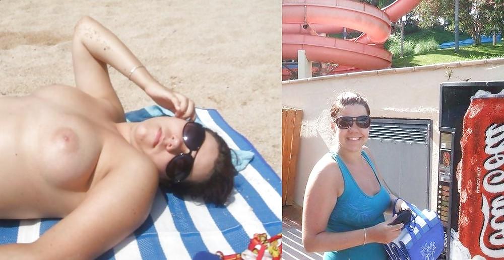 20P Before after 341 (Beach special).