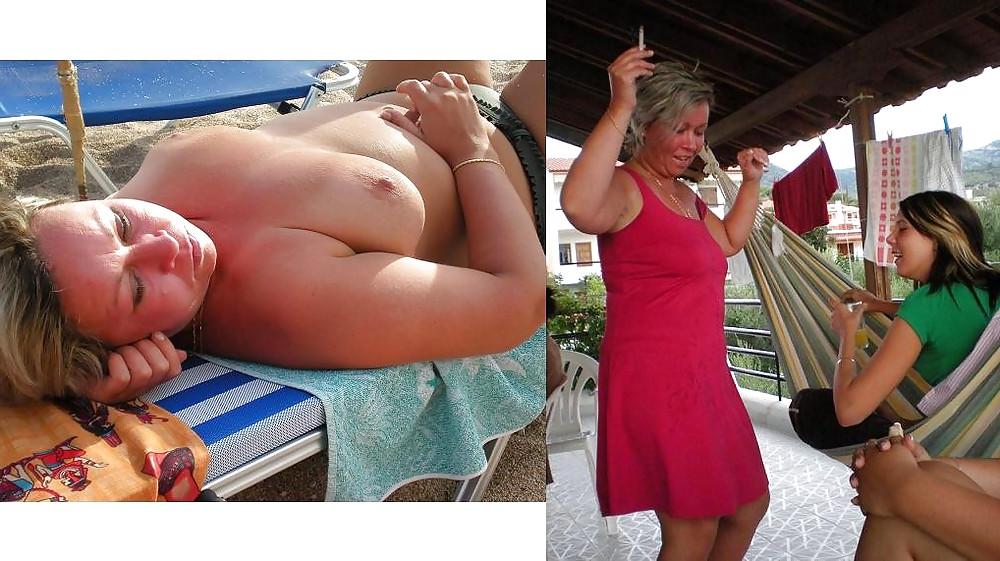 20P Before after 341 (Beach special).