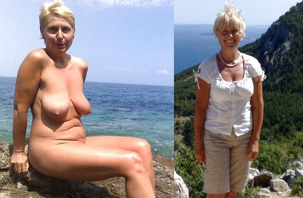 20P Before after 341 (Beach special).