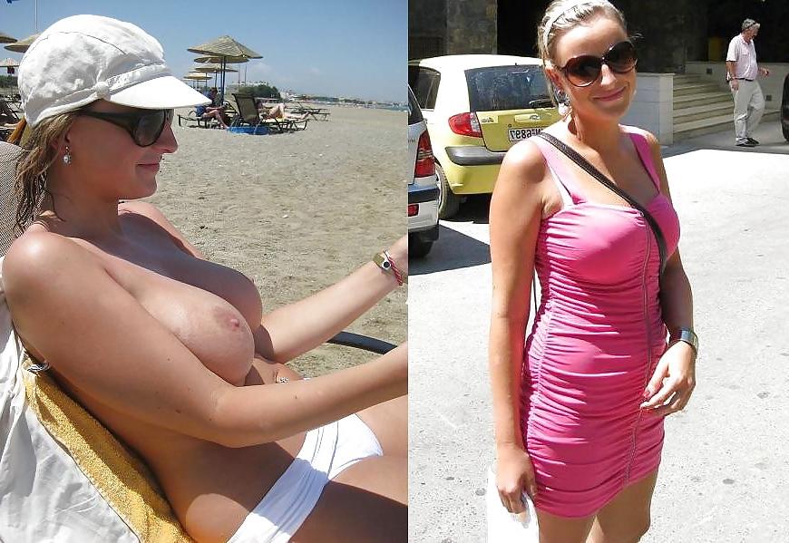 20P Before after 341 (Beach special).