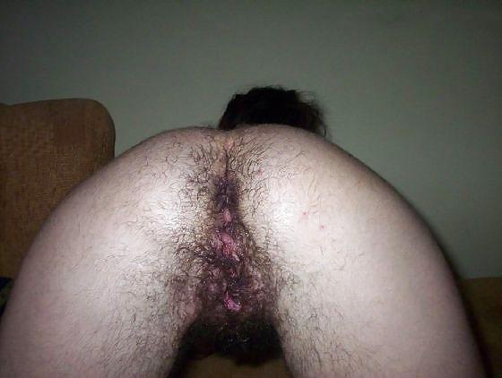 25P Michuu very hairy woman