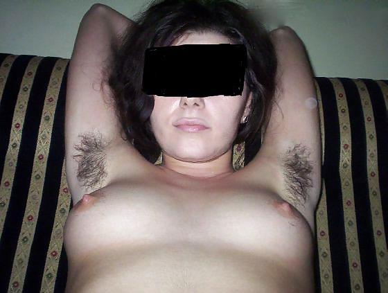 25P Michuu very hairy woman