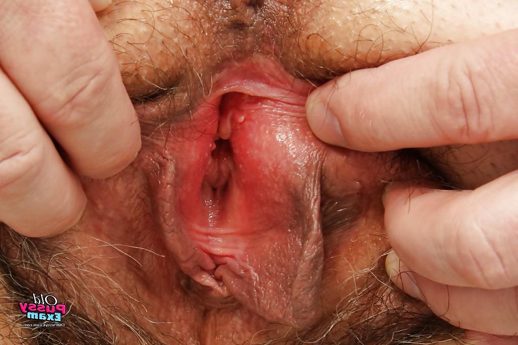 16P Fat mature visits the gyno &amp; spreads her hairy bush for pussy viewing
