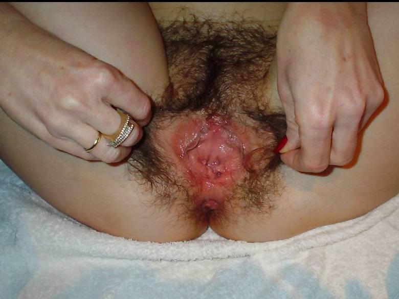 20P Hairy pussy
