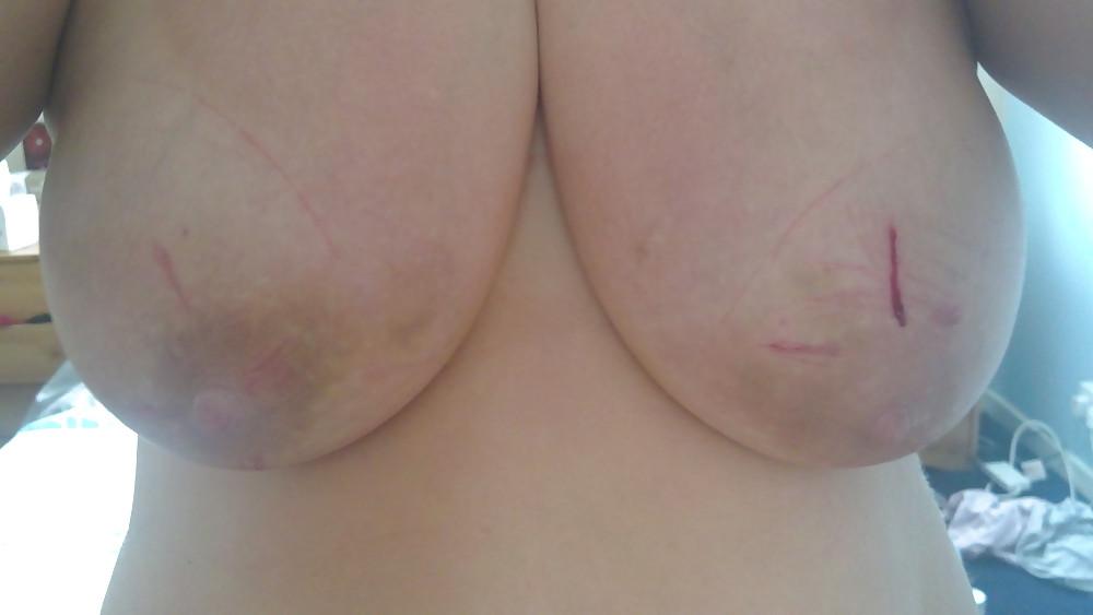 9P Scottish slut tortured again