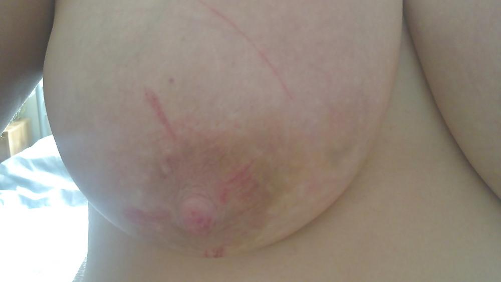 9P Scottish slut tortured again