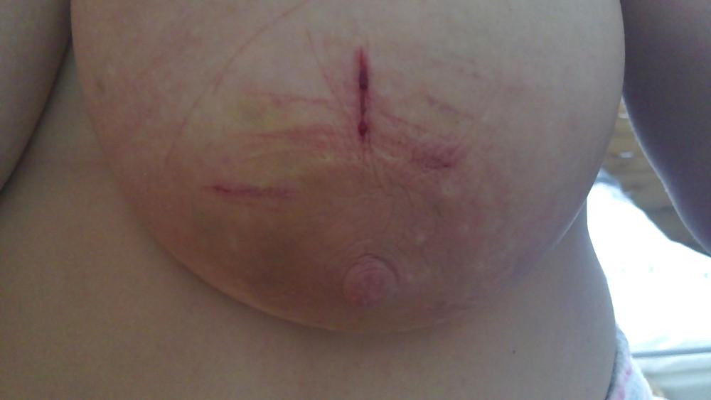 9P Scottish slut tortured again