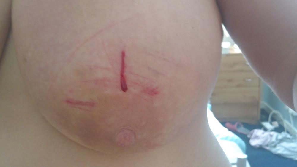 9P Scottish slut tortured again