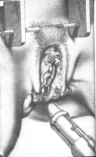 15P trapped in bondage tied with ropes and leather bdsm artworks