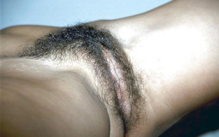 25P HAIRY WIFE NAKED
