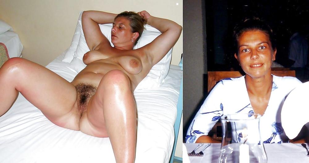 25P Dressed - Undressed Hairy Women Part 20