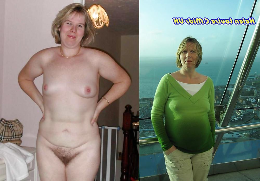 25P Dressed - Undressed Hairy Women Part 20