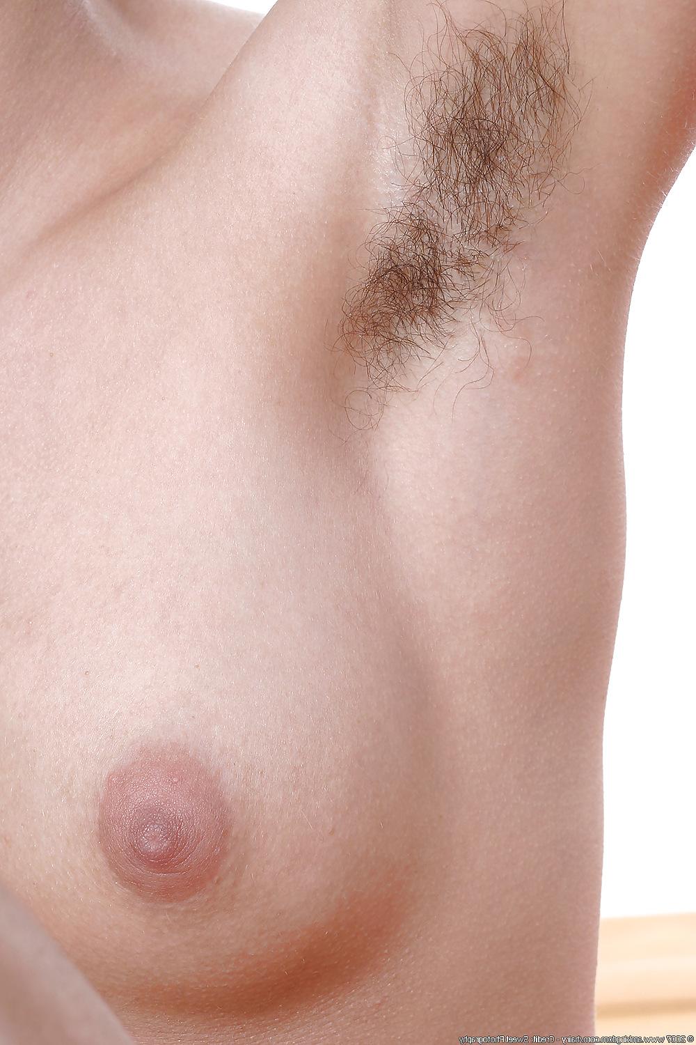 15P Hairy