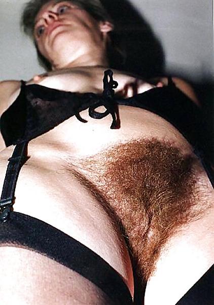 25P Giant Hairy Women II