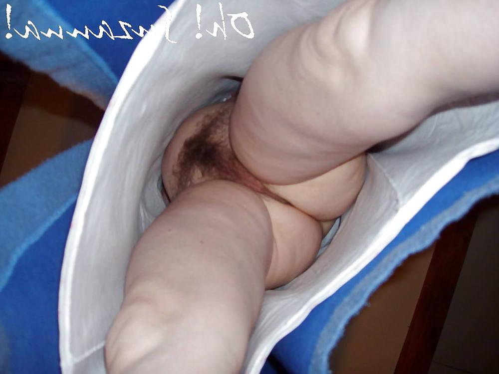 25P Giant Hairy Women II