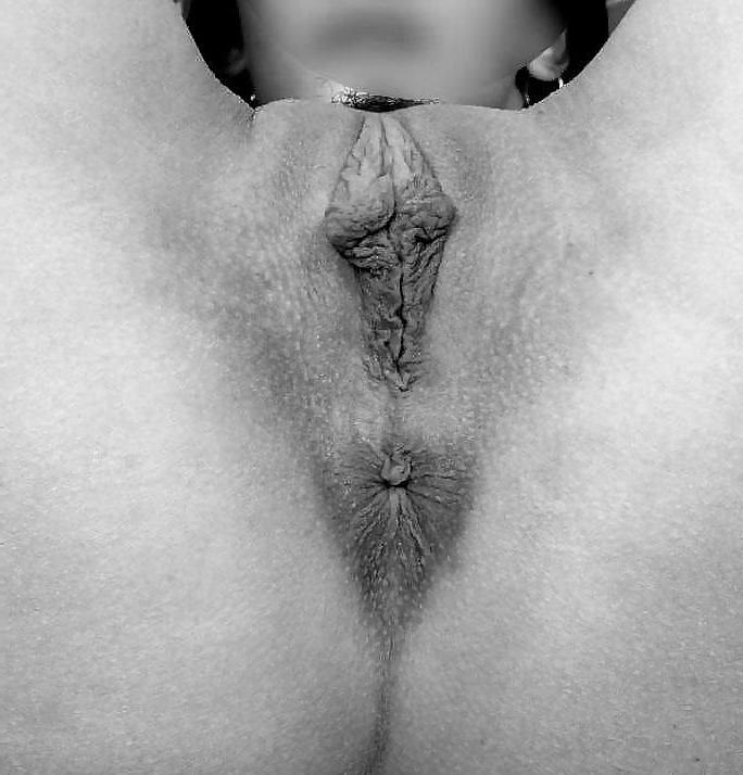 25P Deep Hole