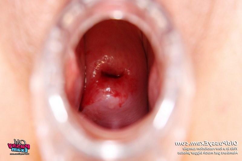 15P Nada mature woman visits her gyno doctor to have her pussy examined