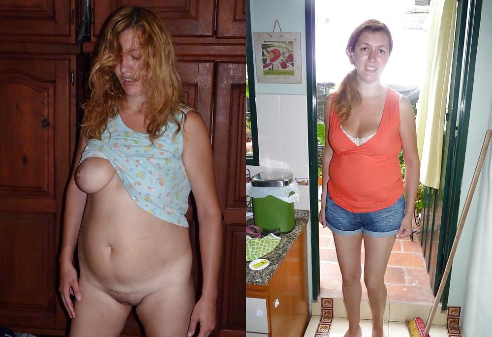 17P Woman Before and After