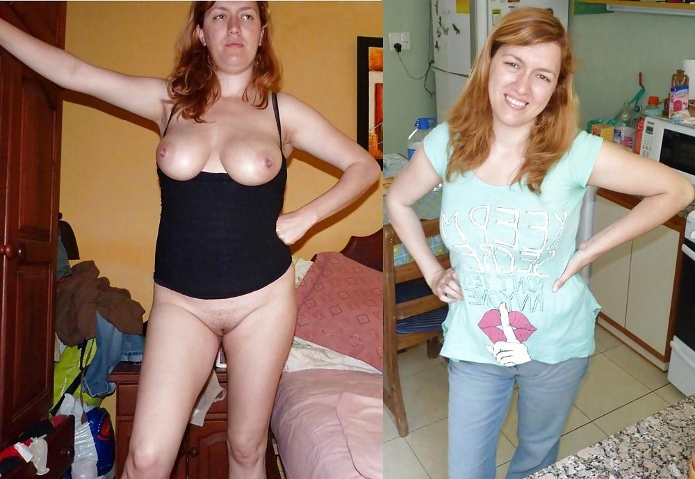 17P Woman Before and After