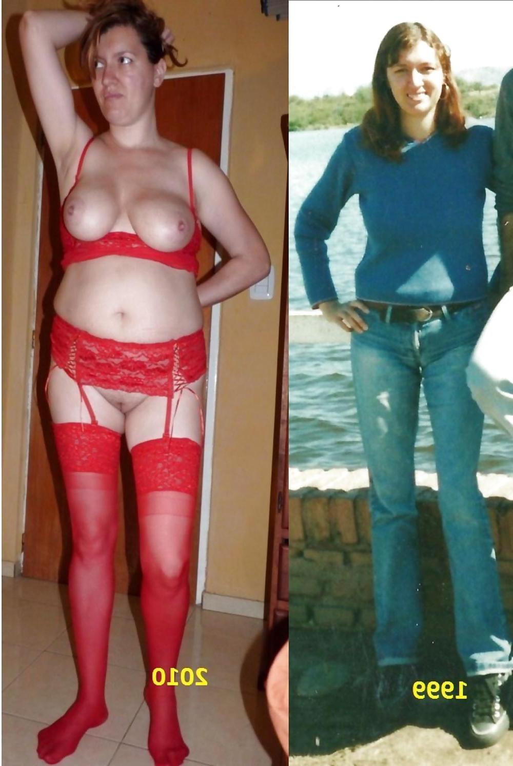17P Woman Before and After