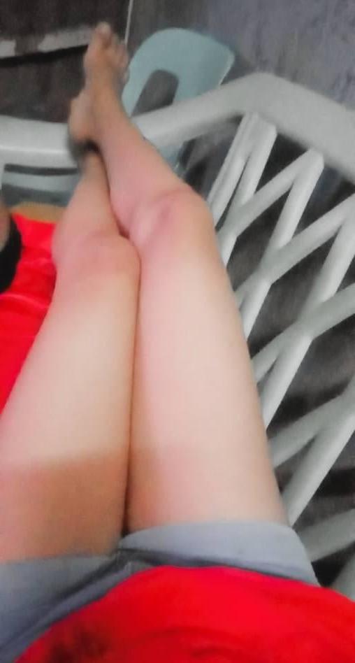 25P Legs