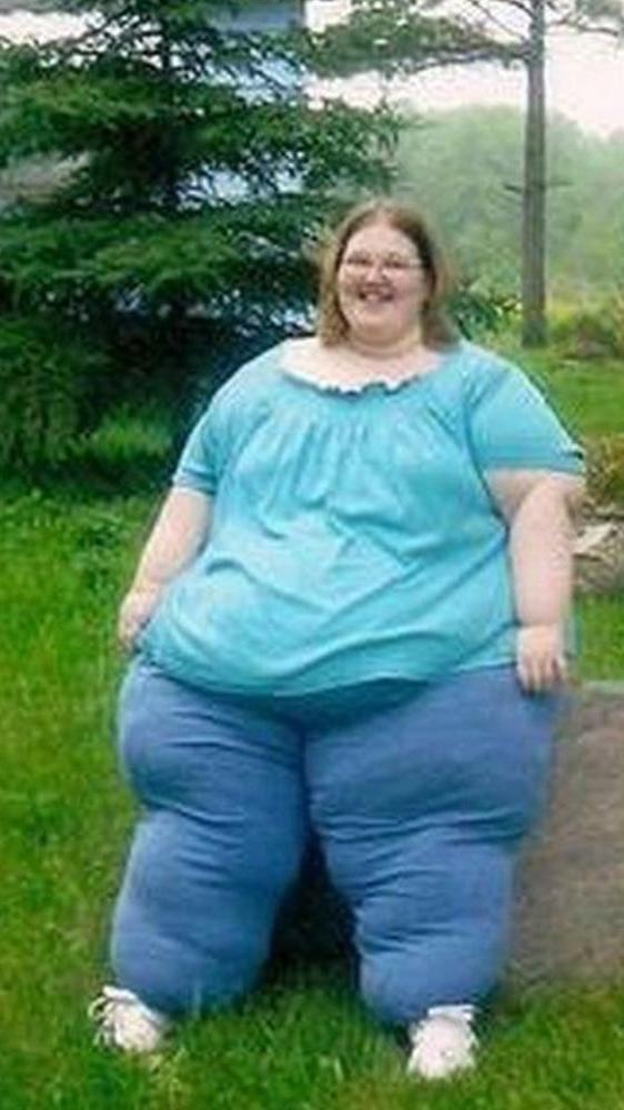25P SSBBW Elephant Legs