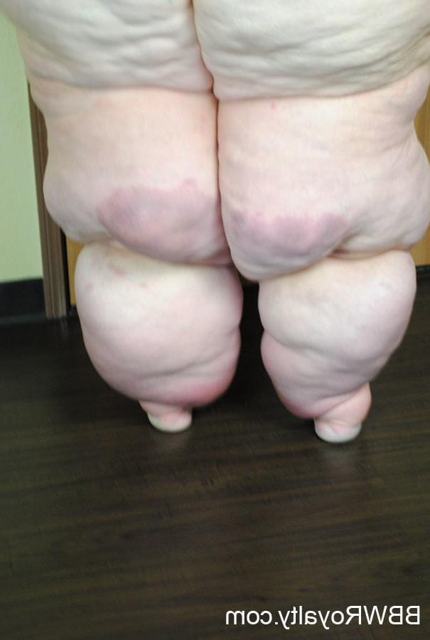 25P SSBBW Elephant Legs