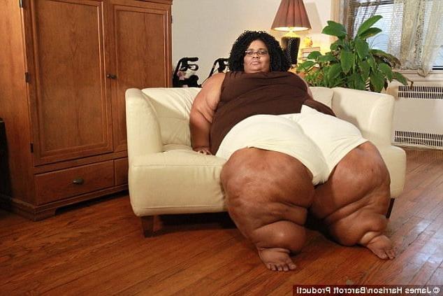 25P SSBBW Elephant Legs