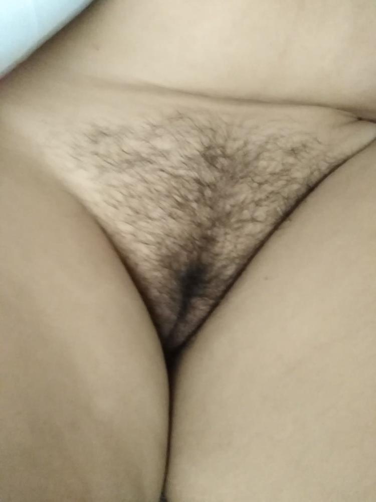 8P Hairy