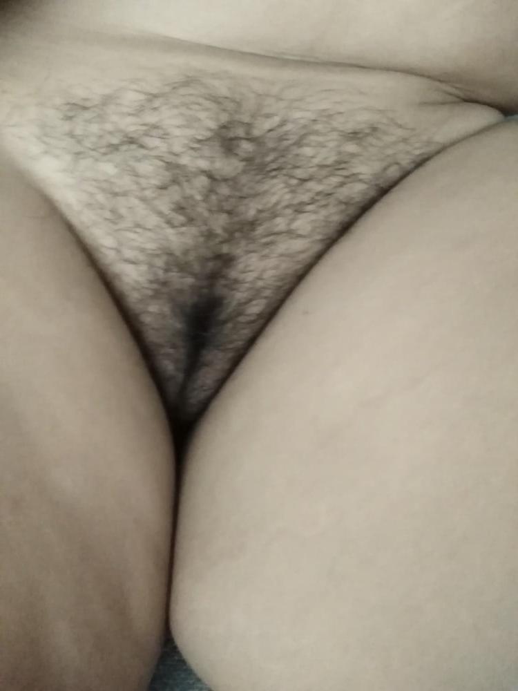 8P Hairy