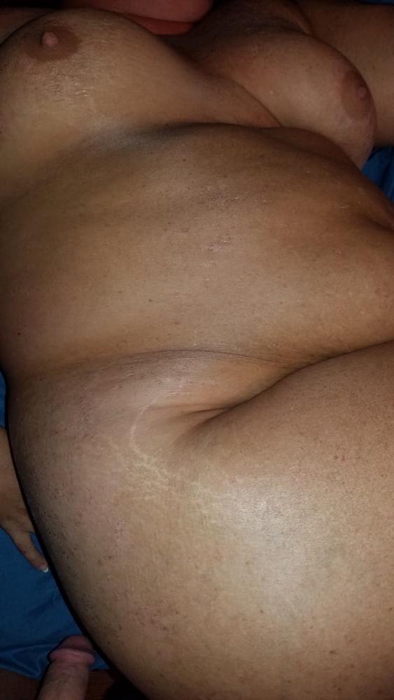 5P More of Hairy Tilly