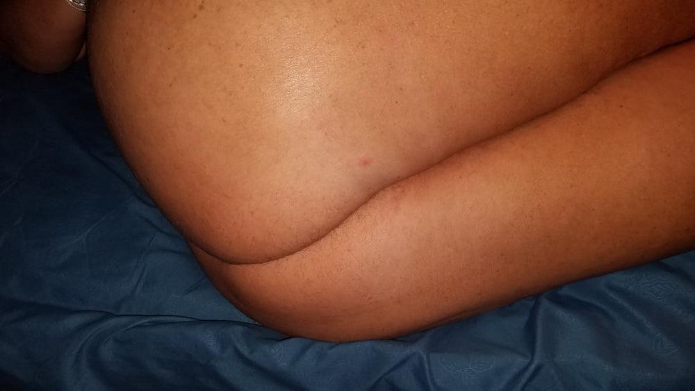 5P More of Hairy Tilly