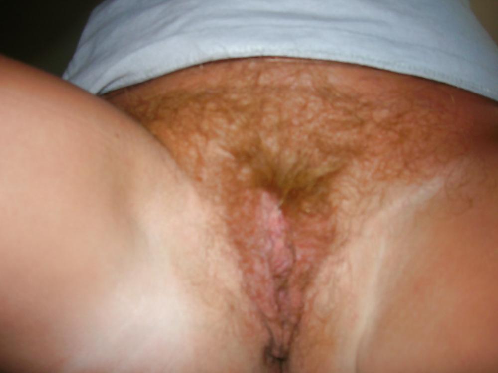 21P Hairy bush