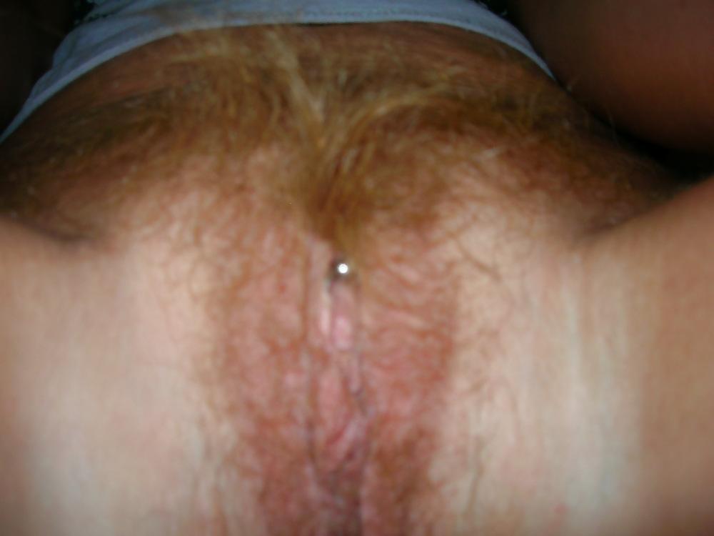 21P Hairy bush